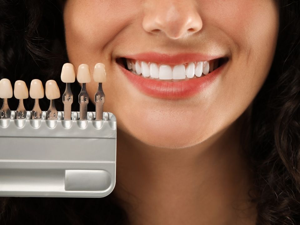 Facetas em Resina & Estética do Sorriso em Duque de Caxias - Dra. Lidia Eugenio Figueiredo