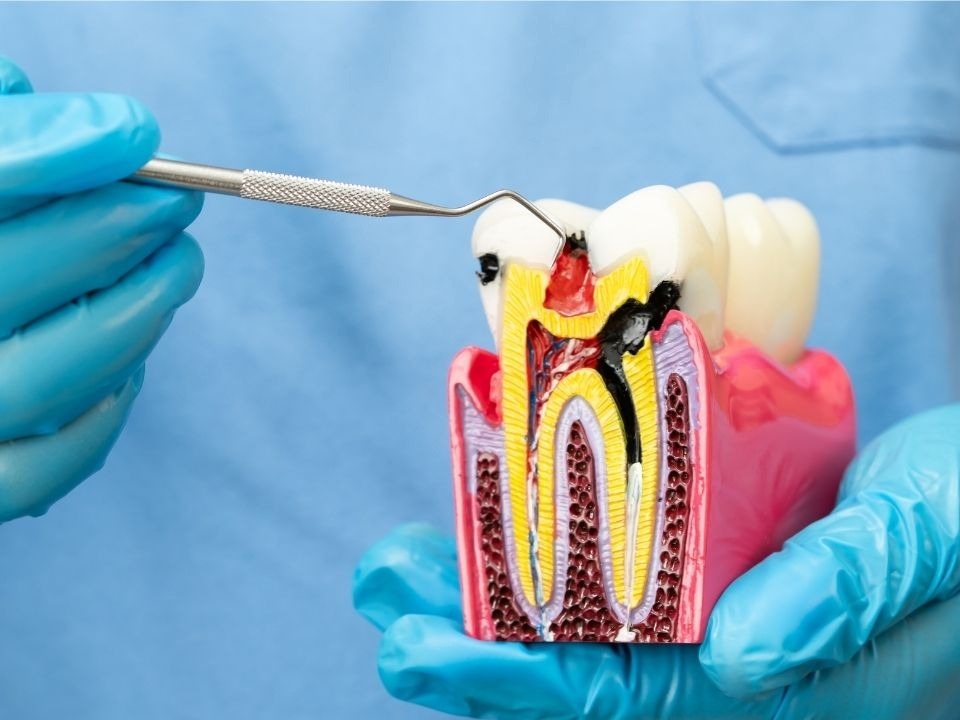 Endodontia / Tratamento de Canal em Duque de Caxias - Dra. Lidia Eugenio Figueiredo